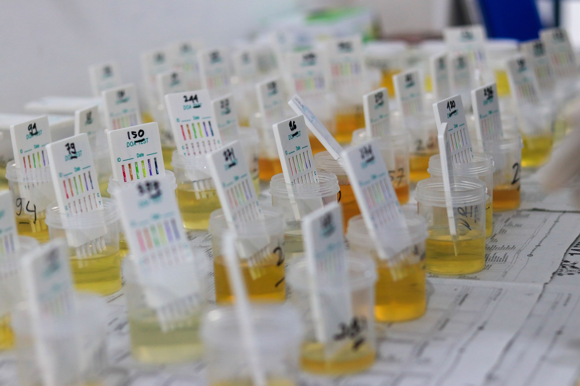 Urine Test Kit: Rapid Detection for Drug Abuse